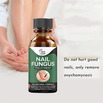 Fast Нокти Anti-Fungal Nail Repair Liquid Pen Fungus Пръсти Пръсти Нокти Care Nail Toe Fungus Remova Paronychia Onychomycosis TSLM1